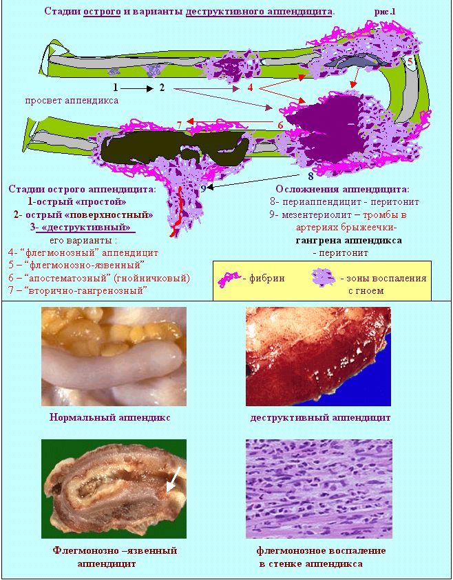 Болезни органов пищеварения. (часть 2 - болезни кишечника)