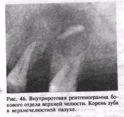 Значение татуировок Дельфин Дерматолог Задать вопрос врачу