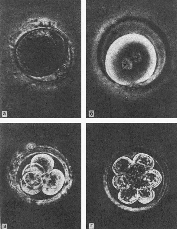 Яйцеклетки сохраняют способность к оплодотворению. Зигота это оплодотворенная яйцеклетка. Гамета зигота эмбрион. Микрофотография оплодотворенной яйцеклетки. 2 Бластомера эмбрион.