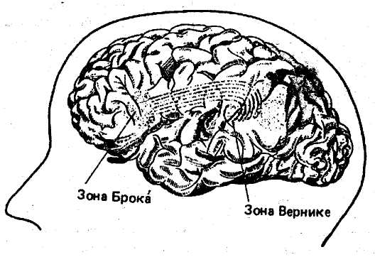 Поль брока. Афазия Брока мозг. Поль Пьер Брока. Мозг зоны Брока и Вернике. Поль Брока центры Брока.