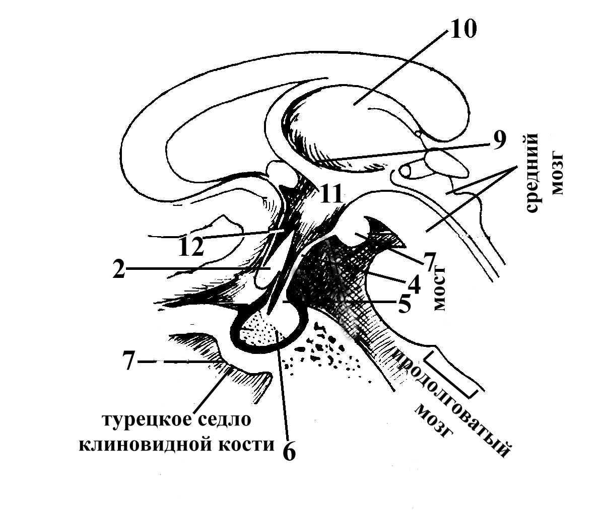 Формирующееся турецкое седло в головном мозге