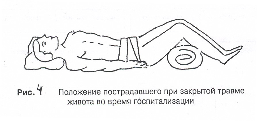 положение пострадавшего при травме живота. придать пострадавшему положение при травме живота. положение при травме живота. придать пострадавшему положение при травме живота. оказание первой помощи при повреждении живота.