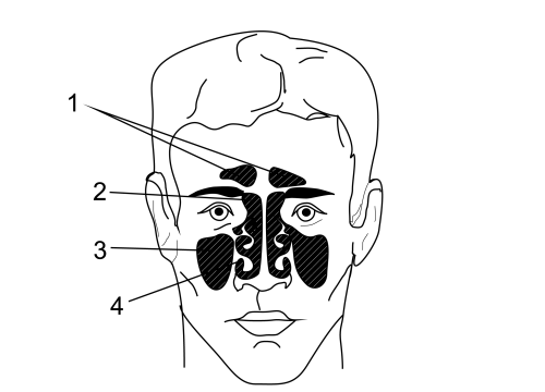 околоносовые пазухи строение. строение пазух на кт. проекции придаточных пазух носа. проекции придаточных пазух носа. расположение придаточных пазух.