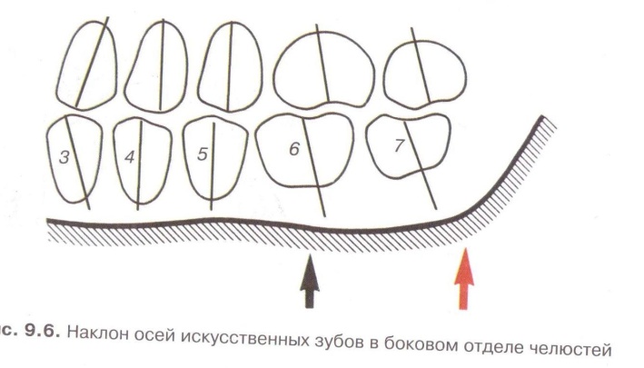 Постановка по стеклу
