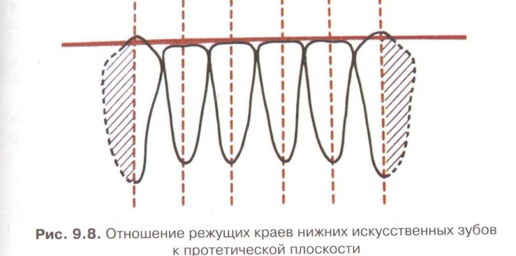 Постановка по стеклу