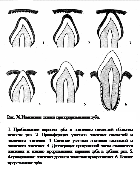 Пульпа молочных зубов анатомия. Болезнь несовершенный остеогенез. Молочные и постоянные зубы. Временные и постоянные зубы. Пульпа молочных зубов анатомия.