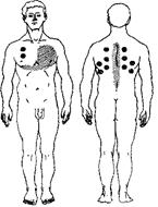 Как правильно ставить банки схема