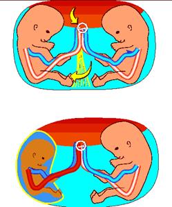 Пуповина и ребенок схема