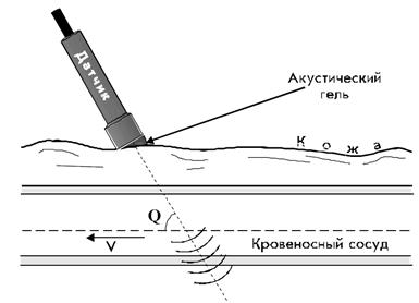 Для получения изображений в ультразвуковых сканерах используются