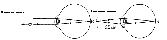 схема преломления лучей хрусталиком глаза. аккомодация ближайшая точка зрения. ближняя точка аккомодации. дальнейшая точка ясного видения. пресбиопия (возрастная дальнозоркость).