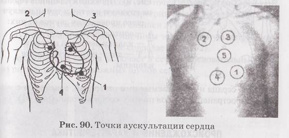 Точки аускультации сердца рисунок