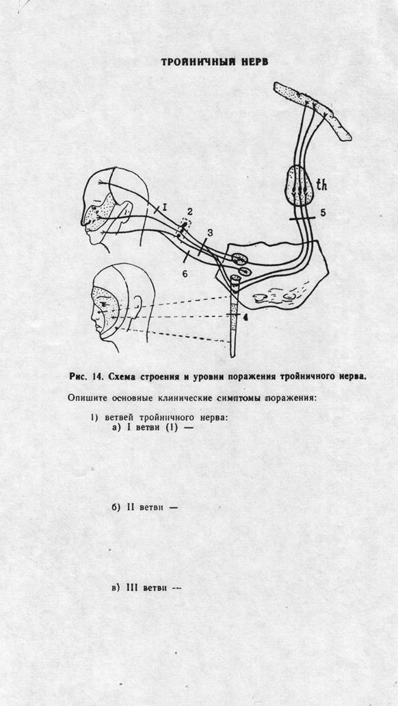 Схема подъязычного нерва