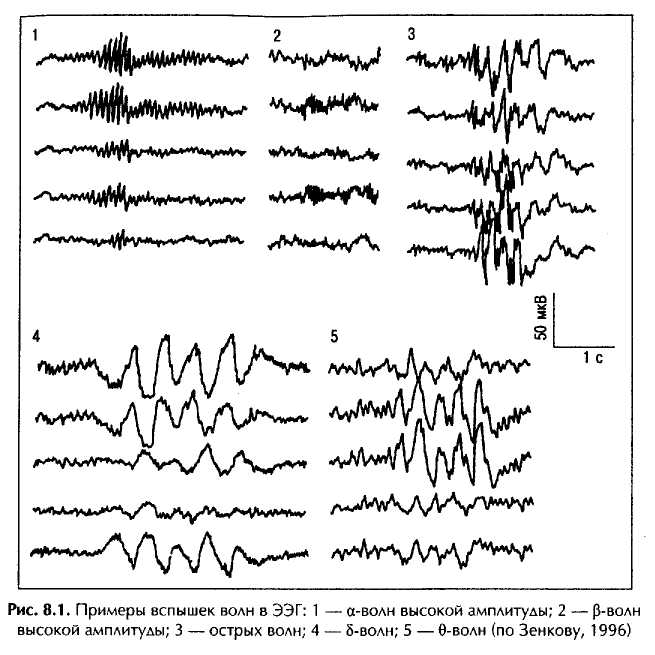 Принцип метода электроэнцефалографии нарисовать и охарактеризовать основные волны ээг