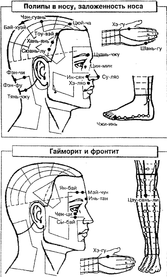 Бальзам звездочка точки нанесения схема. Точечный массаж гайморит фронтит. Массаж от заложенности носа. Какую точку массировать при заложенности носа. Гайморит точки акупунктуры.